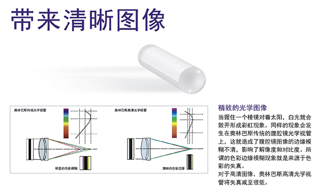 奥林巴斯高清腹腔镜