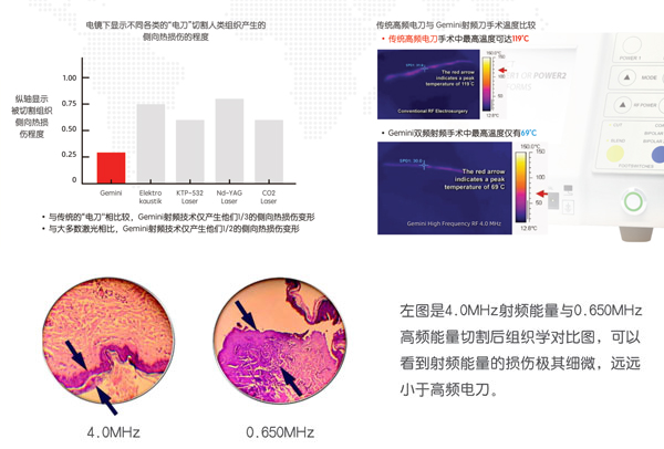 低温射频刀切割组织损伤更低