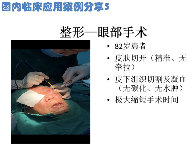 低温射频刀眼科整形手术应用